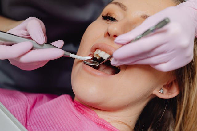 Koje probleme rešavaju navlake za zube?